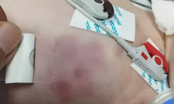 Casal suspeito de quebrar costela de bebê de 17 dias é preso preventivamente, diz polícia