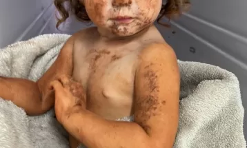 Pais de criança que caiu em buraco com cerca de três metros de profundidade se emocionam com o resgate: 'Foi o maior alívio do mundo'