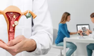 Mitos e verdades sobre endometriose