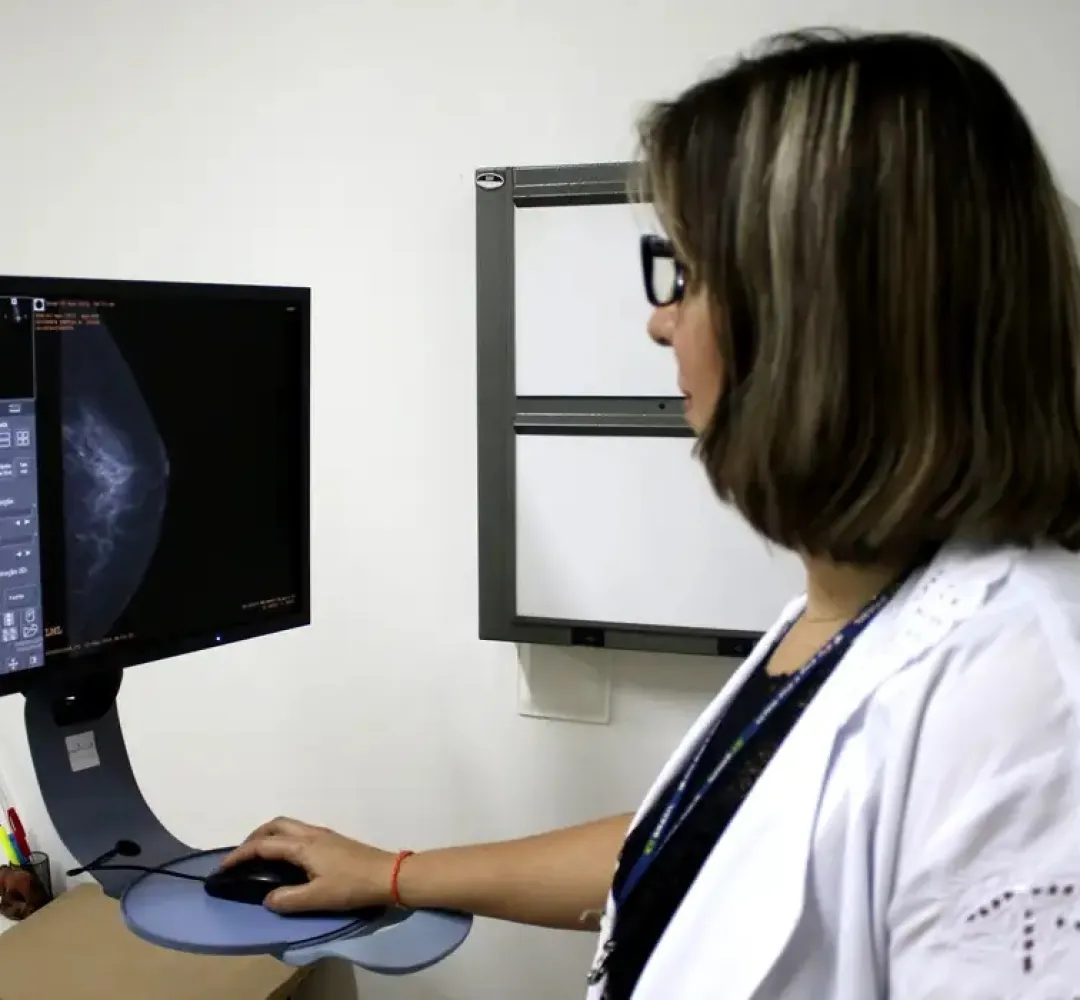 Entidades médicas pedem faixa etária maior para mamografia de rastreio