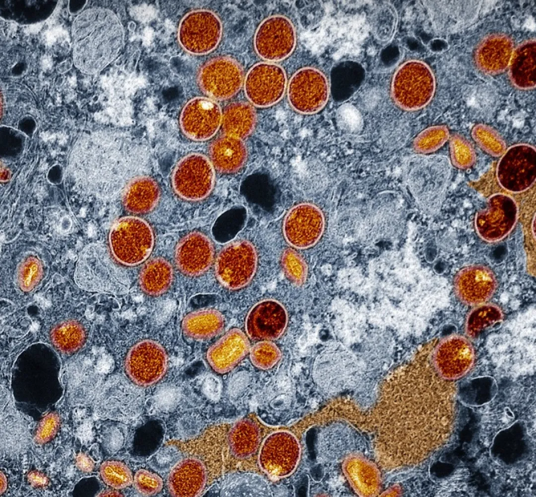 Mpox