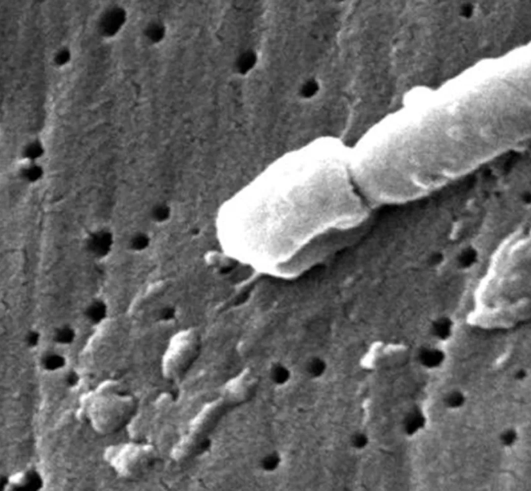 Imagem eletromicroscópica da bactéria