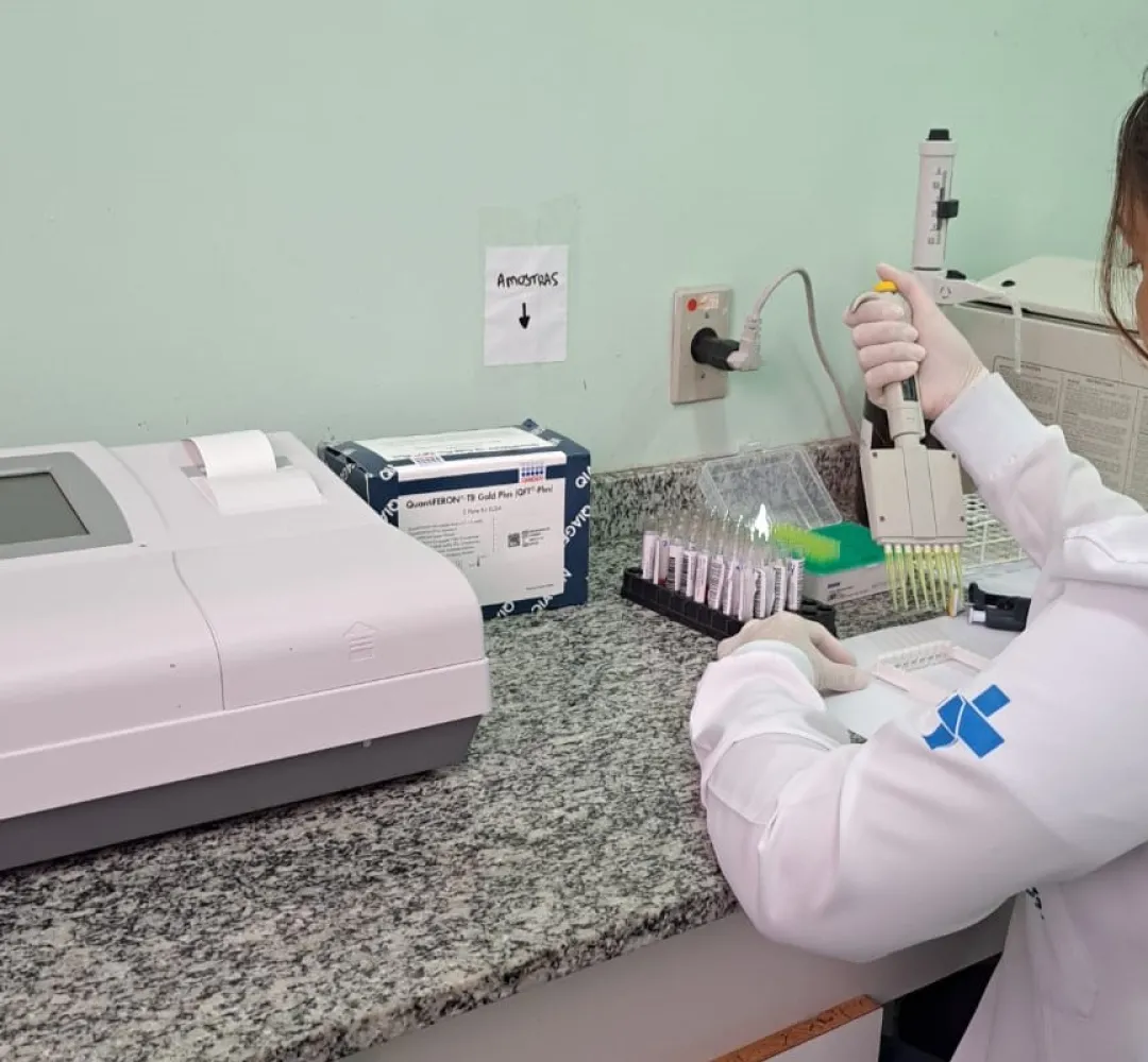 Tuberculose