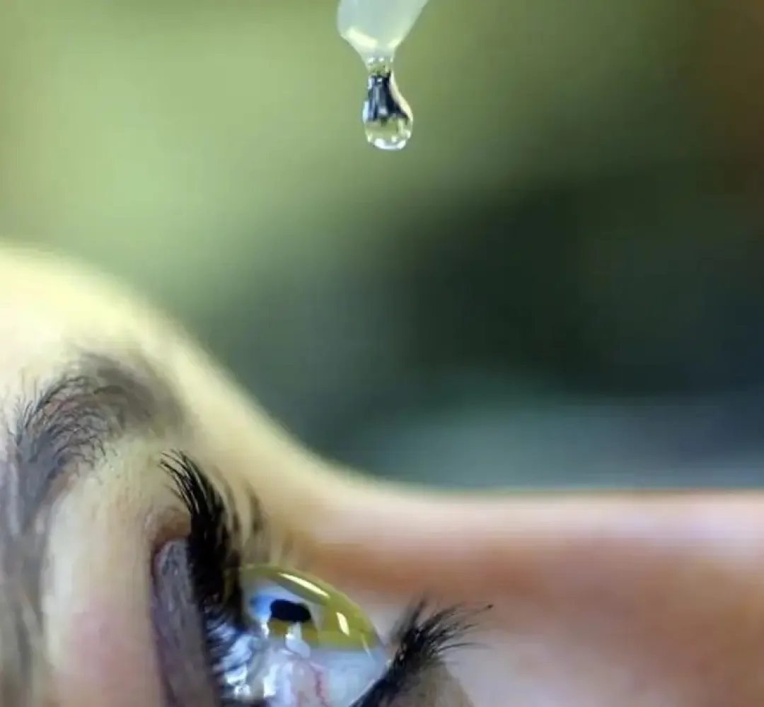glaucoma