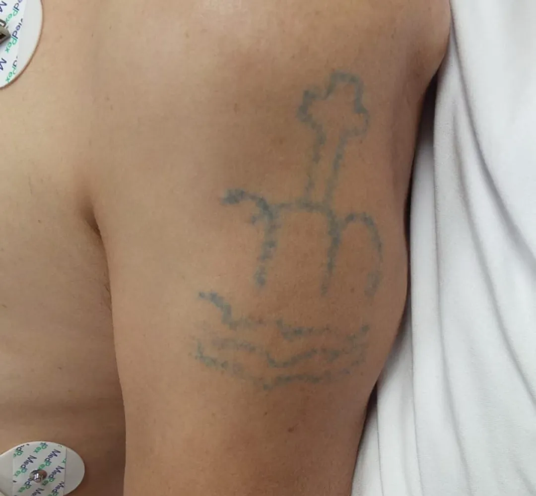 tatuagem