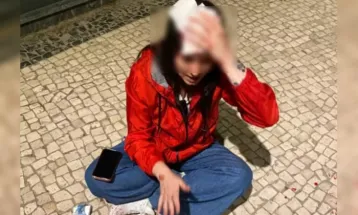 Brasileira leva pedrada na cabeça em Portugal: “Fala baixo, vaca”