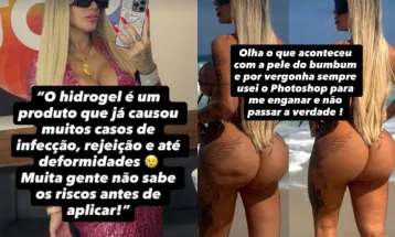 Influenciadora Juju Ferrari passa por cirurgia de emergência para retirada de hidrogel no bumbum