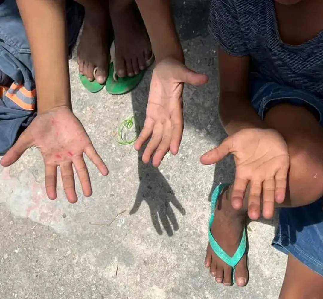 Trabalho Infantil