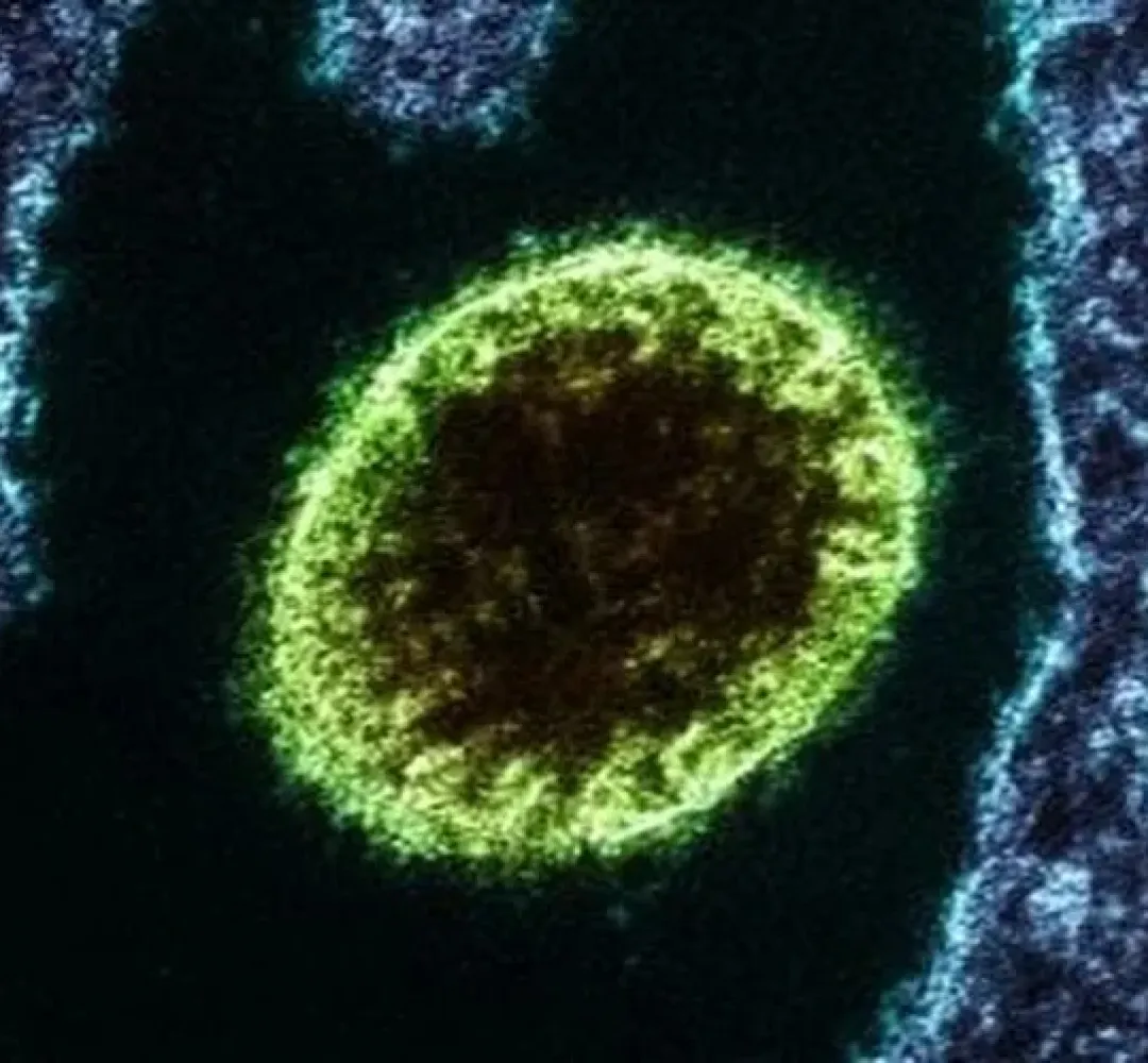 virus nipah