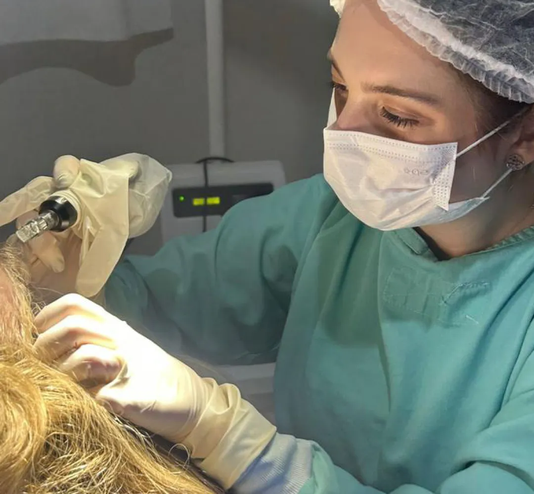 alopecia