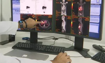 SUS adota novo exame mais preciso para detectar câncer colorretal
