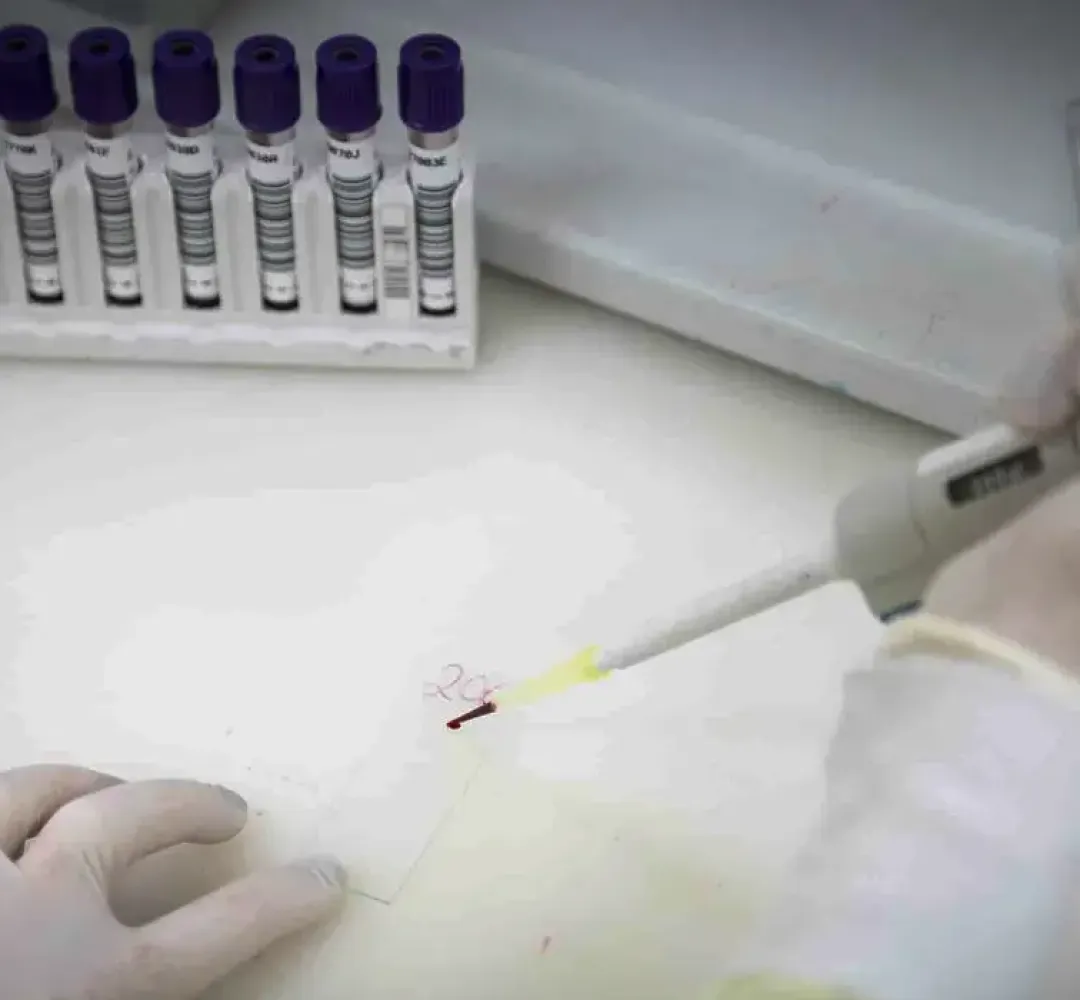 Governo  descarta suspeita Ebola