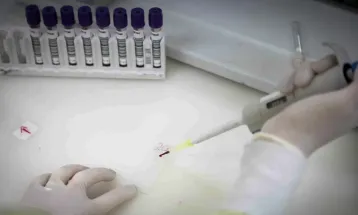 Exames descartam ebola em imigrante internado em São Paulo