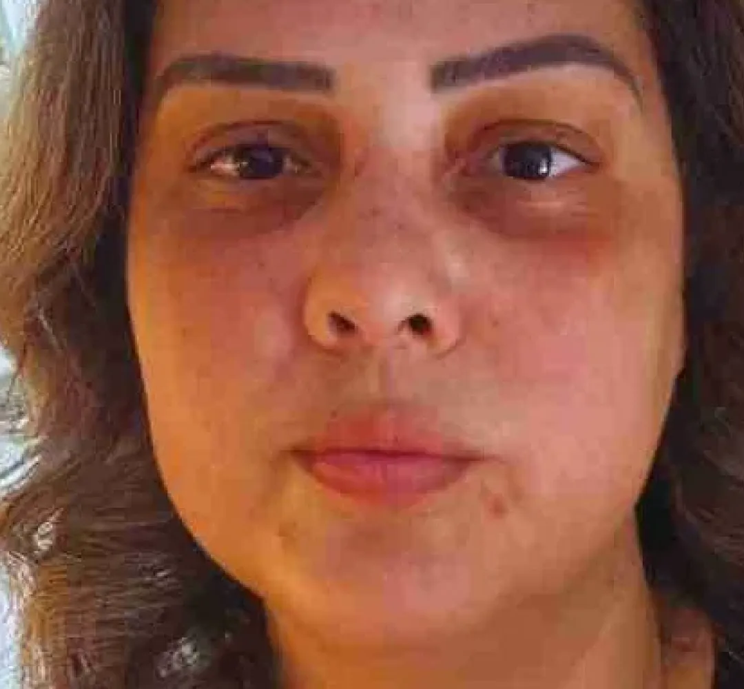 Fabiana Pedrão Nunes morre em acidente