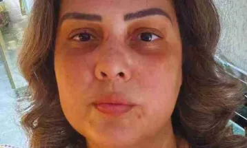 Identificada como Fabiana Pedrão Nunes motorista que morreu em acidente na BR-369